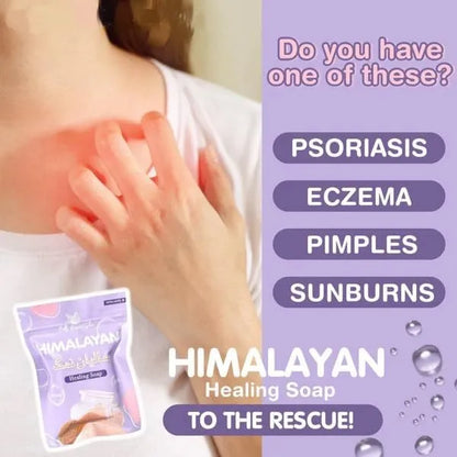 Bella Amore Skin Himalayan Brightening Soap – 130g