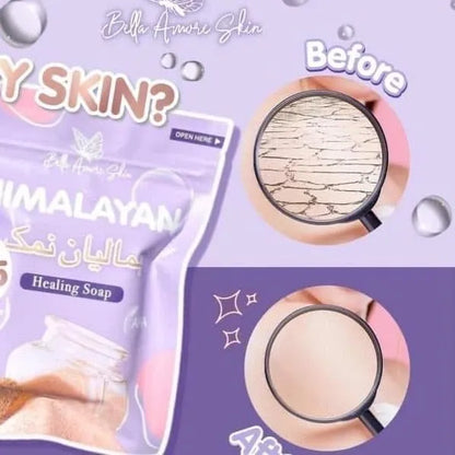 Bella Amore Skin Himalayan Brightening Soap – 130g