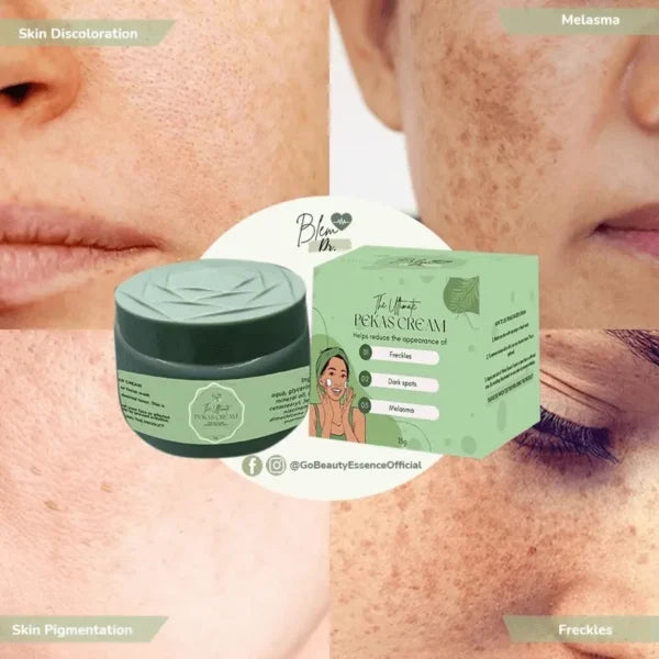 Blem Dr. The Ultimate Pekas Cream – 15g