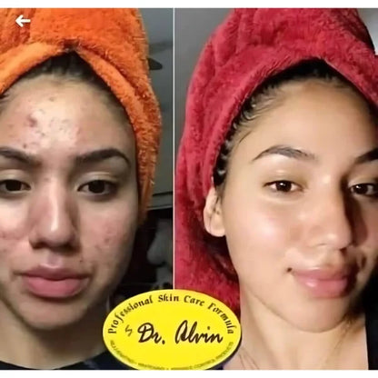 Dr. Alvin The Original Rejuvenating Set No.5