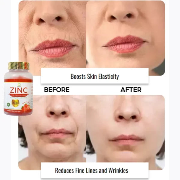 Dr. Pinoca Zinc Extra Strength Gummies