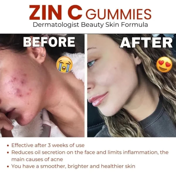 Dr. Pinoca Zinc Extra Strength Gummies