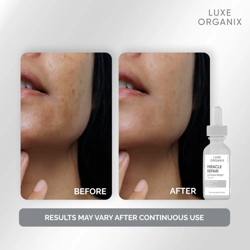 The Ordinary Hydrators & Oil Hyaluronic Acid 2% + B5 – 30ml