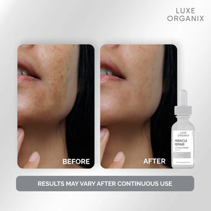 The Ordinary Hydrators & Oil Hyaluronic Acid 2% + B5 – 30ml