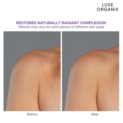 Luxe Organix Retinol + Gluta Youthful Radiance Whitening Serum Lotion – 350ml