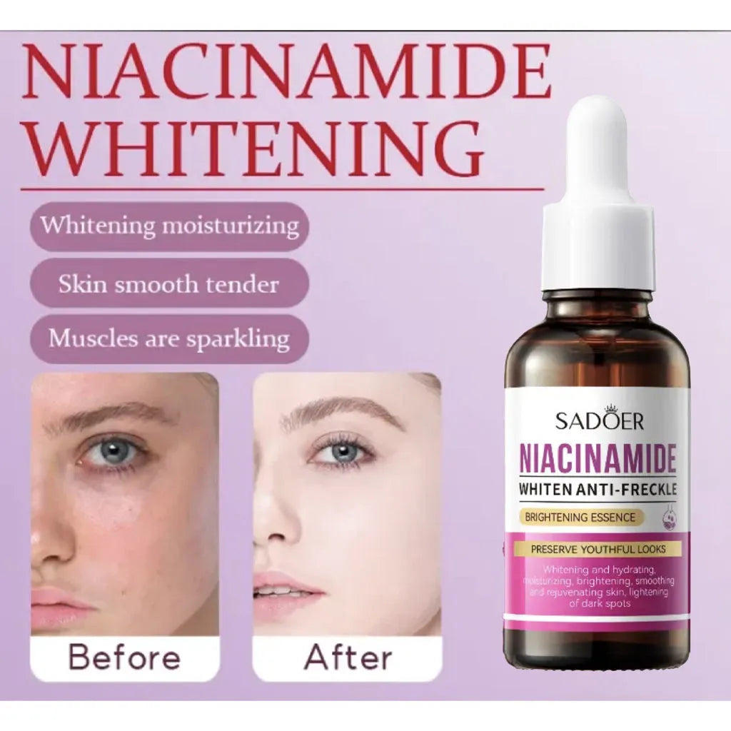 Sadoer Niacinamide Whiten Anti-Freckle Brightening Essence – 30ml