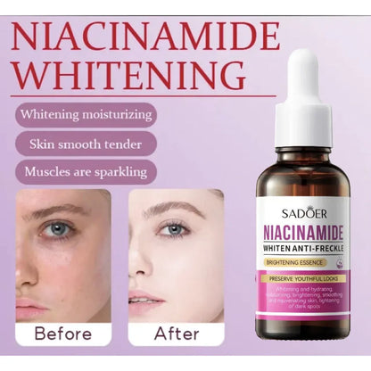 Sadoer Niacinamide Whiten Anti-Freckle Brightening Essence – 30ml