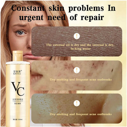 Kniyea VC Toner Sadoer Niacinamide Kiss Beauty Sunscreen Combo